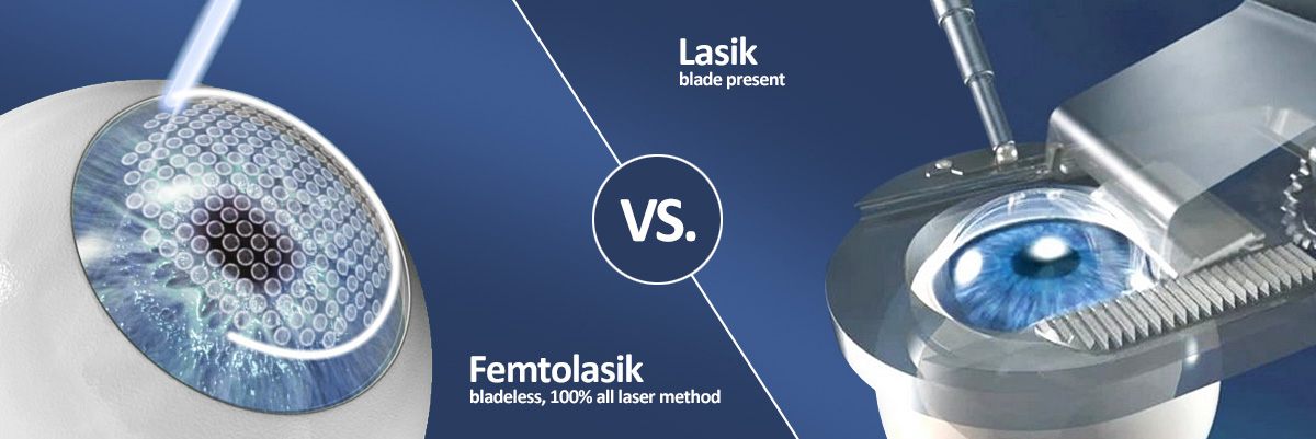 Чим Femto LASIK відрізняється від LASIK