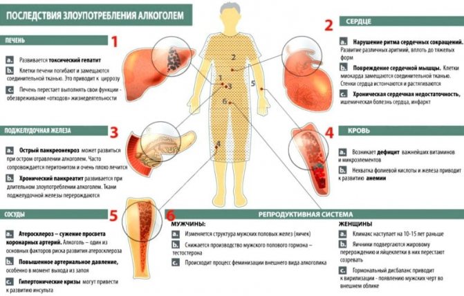 Що робити если перепивши алкоголь и нудити