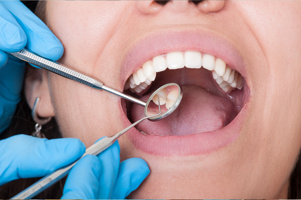 Рекомендації та підготовка до видалення зубів