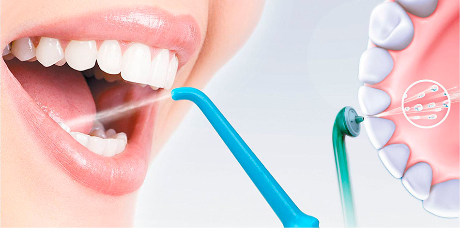 Эффективная чистка зубов ирригатором в домашних условиях