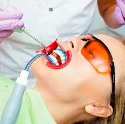 Переваги відбілювання зубів системою Beyond