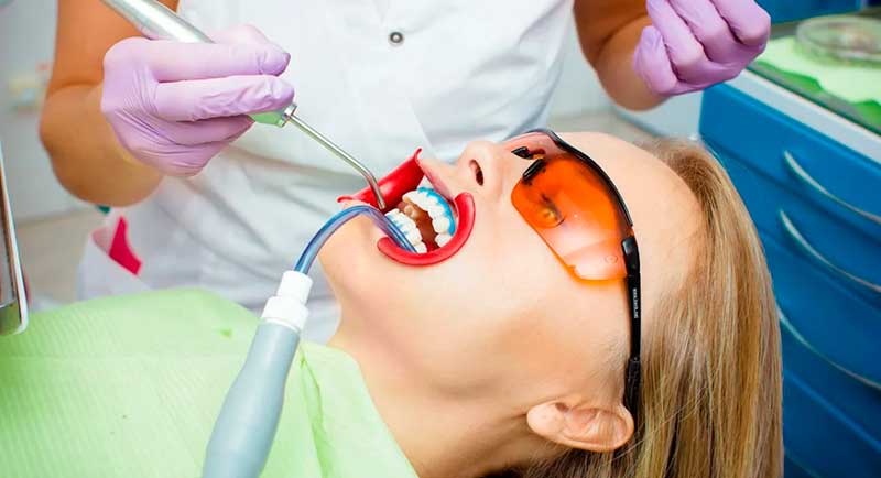 Переваги відбілювання зубів системою Beyond