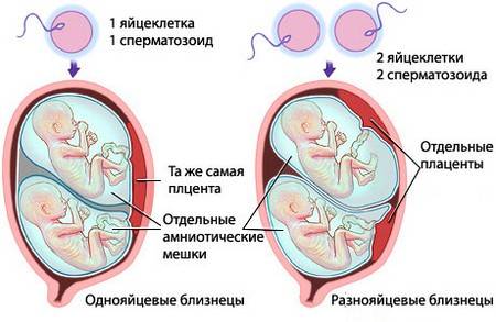 багатоплідна вагітність