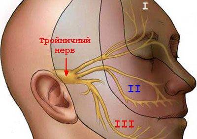 Невралгія трійчастого нерва