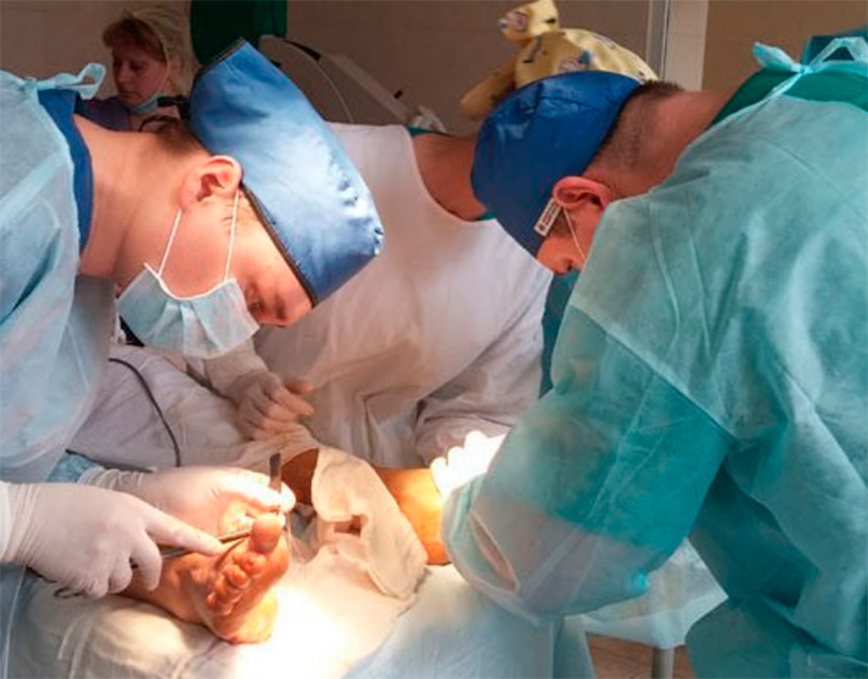 Врач ортопед-травматолог (Засыпка Константин)в процессе реконструкции стопы пациенты