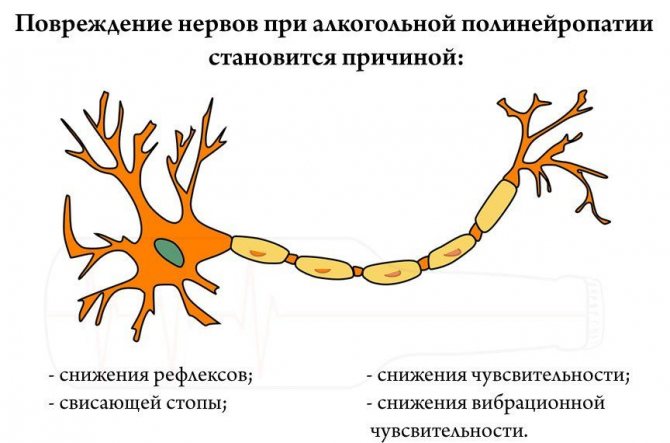 Полінейропатія кінцівок - то багато, симптоми, лікування