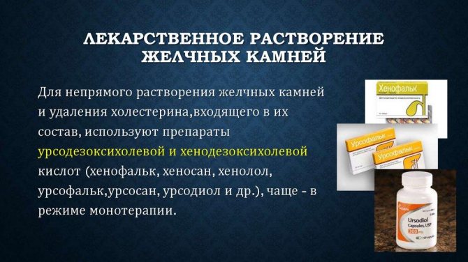 Препарати від жовчнокам'яної хвороби