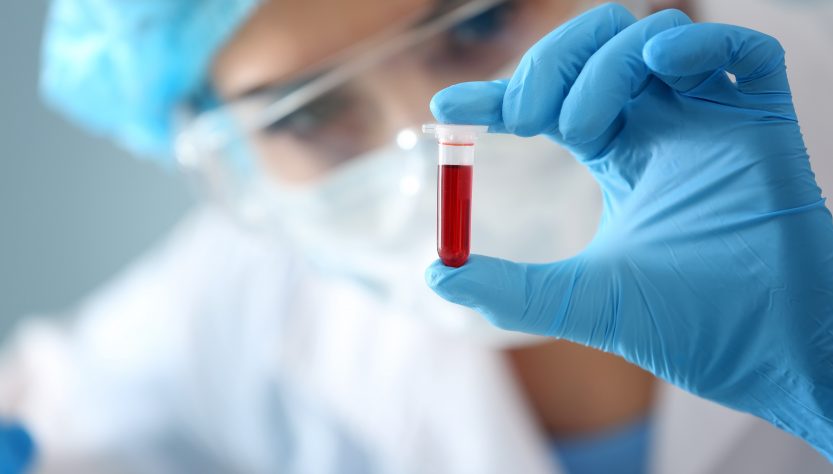 Лабораторное исследование крови