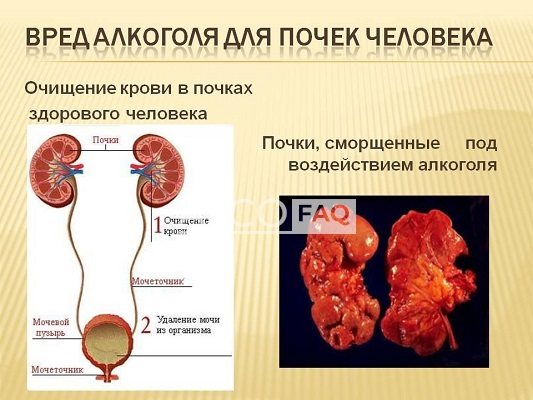 види захворювання